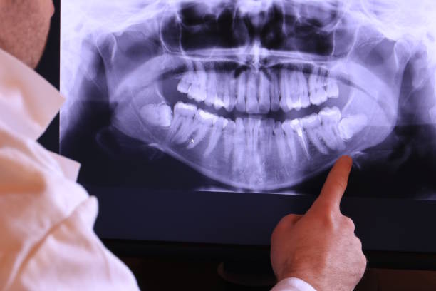 Best Urgent Tooth Repair  in Manson, WA