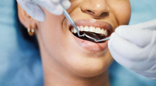 Best Root Canal Emergency Dentist  in Manson, WA